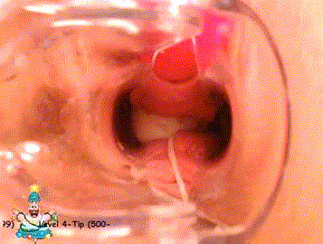 图片[8]-【内窥】探秘阴道子宫深处 阴道内窥集合【80V 8.78G】【PK】 • 欲泽社 - 全网每日精品资源-欲泽社 - 全网每日精品资源